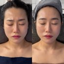 상봉빌딩 | 상봉 에스테틱 에스테티아 망우역점 윤곽관리 1회 후기