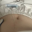 협진산업(주) | 다이어트| 한의사의 마운자로 체험기 그리고 다이어트 한약, 환, GLP-1