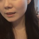 더퍼스트피부과의원 | [창원 중동] 내돈내산 기미 제거 후기 : 창원퍼스트피부과의원