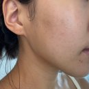 다이온메디 | 수분진정미스트 추천 피부가 어려지는 메디쥬얼리