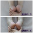 김포출장마사지 이미지