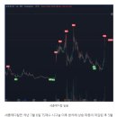 TS메디칼 이미지