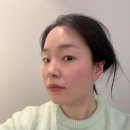 뷰앤플의원 | [온다리프팅] 3회차 점점 느껴지는 변화 온다리프팅 8만줄 뷰컷 솔직 후기