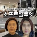 하나 소프트 | 신사피부과 실루엣소프트 실리프팅 회복기간 통증 효과 상세후기