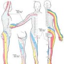 신경근병증[radiculopathy] 이미지