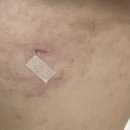 더뺌의원 | 부산 마더즈의원 | 20대 맘모톰후기, 1인실, 비용/통증, 김상원 대표원장님