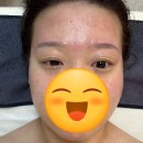 비엘짐 | 천안 두정동 비엘뷰티 수분관리 MTS 관리 후기 두정동에스테틱 웨딩관리 왁싱 피부관리