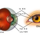 눈동자로 알 수 있는 우리 몸의 병 이미지