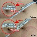 레드핏 | 대전서구피부샵 바디관리 맛집 에이아이앤비 레드핏 후기