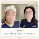 이브 | 부평에스테틱 [피움에스테틱] 온다웨이브 후기💚 얼굴윤곽 관리 제대로 받았어요 :)