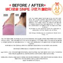 서산동문동체형교정센터 SNPE운동 꼭 해야하는 이유가 무엇일까? 꼭 #SNPE운동을 해야하는 이유