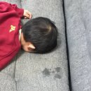 대한P&J | [잠실] 매복사랑니 발치 후기