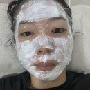 안산 중앙동 피부과 봄철 피부관리 잇츠미의원에서 스킨부스터 3회차 후기