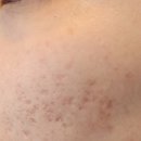 최종원한의원 이미지