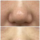 콜드플라즈마 이미지