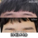 쁘띠유 | 권선동눈썹 쁘띠유 남자 자연눈썹 후기 리터치포함