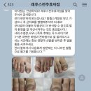 레푸스전주 이미지