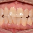 좌동로 93 이미지