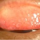 비엔나안경 이미지