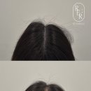 리헤어라인 - 논산시 | 리헤어라인