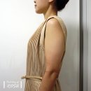 다이어트주사 4회차 기록 - 말라간다 / 지방분해주사가격 궁금?