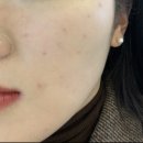 신진로얄 아파트 | 김해피부관리/스파,누리봄에서 오투덤 테라피 받은 후기