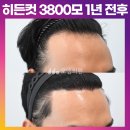 [30대 남자 M자 이마 모발이식 생착률 높은 후기] 비절개 히든컷 3800모 1년 전후 (모엠의원/M자탈모/전지훈원장) 이미지