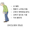 파킨슨병(Parkinson's disease)증상자세 불안정, 손떨림, 자세이상, 경직, 보행이상, 수면장 이미지