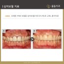 애프터기공소 이미지