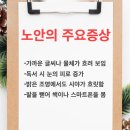 창원글로리안과