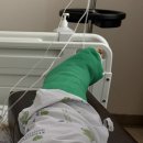 수 가축병원 | 강동경희대병원 발목 뼛조각 제거 수술 후기.. 정형외과 경민규 교수님⭐️