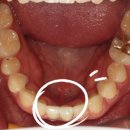 동그라미 치과기공소 이미지
