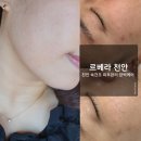 르베라천안점
