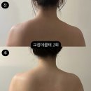 피부의정석
