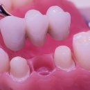 리빙웰치과병원 이미지