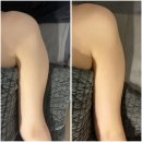 신림 피부관리 에스테틱 몽프로디 뼈팔 내돈내산 1회차 후기