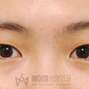 에이엠성형외과의원 네이버블로그