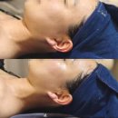 대전 신부관리 잘하는 곳, 저통증+고효과 리프팅 전문점 둔산동 '데이미즈' 리얼 후기
