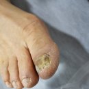 서울활짝편재활의학과의원 네이버블로그
