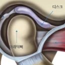 턱관절 염증 통증 원인 주사 치료 개선 방법 이미지