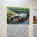미라클효소찜질
