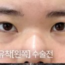 리미트성형외과의원 이미지