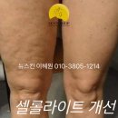 문샵 | 승모근 통증, 허리통증, 셀룰라이트까지? 일산 문샵스킨앤바디에서 한 번에 해결!!