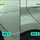 자동차성형외과 이미지