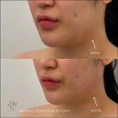대상기술단 | 강남 논현동 소노온코리아에서 문제성 피부 극복한 리얼 경험담