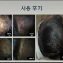 한방탈모치료제품 'BC5' 무료체험단 모집 (2009.4.28~5.5) 이미지