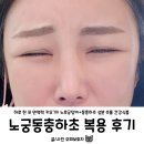 노궁동충하초 복용후기😫 [노루궁뎅이버섯 + 동충하초] 몸 찬사람한테 추천