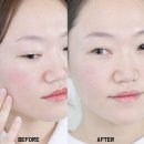 유니스킨앤드바디 | 민감성피부 커런트바디 LED마스크 홈케어 3주 사용후기