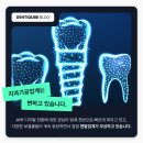 이건치과기공소 네이버블로그