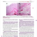 급성 췌장염이 있는 환자의 gastric wall 초음파학적인 특징에 대한 논문 이미지